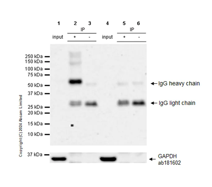 Immunoprecipitation - Anti-STT3A antibody [EPR29178-10] - BSA and Azide free (AB320832)