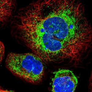 Immunocytochemistry/ Immunofluorescence - Anti-STT3B antibody (AB122351)