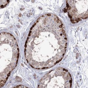 Immunohistochemistry (Formalin/PFA-fixed paraffin-embedded sections) - Anti-STT3B antibody (AB122351)