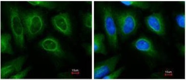 Immunocytochemistry/ Immunofluorescence - Anti-STUB1/CHIP antibody (AB228742)
