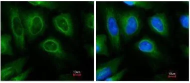 Immunocytochemistry/ Immunofluorescence - Anti-STUB1/CHIP antibody (AB228742)