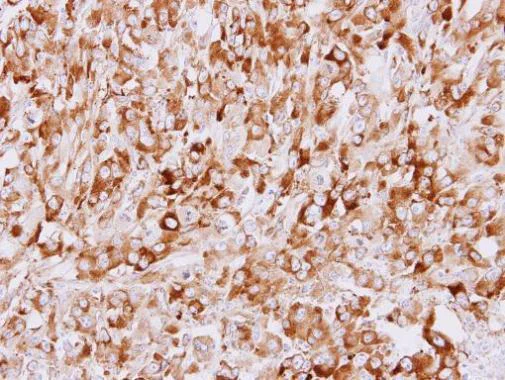 Immunohistochemistry (Formalin/PFA-fixed paraffin-embedded sections) - Anti-STUB1/CHIP antibody (AB228742)