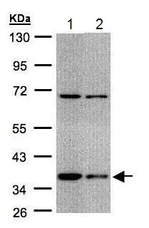 Western blot - Anti-STUB1/CHIP antibody (AB228742)