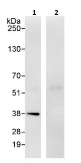 Immunoprecipitation - Anti-STUB1/CHIP antibody (AB264213)