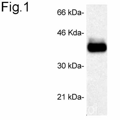 Western blot - Anti-STUB1/CHIP antibody (AB2917), expandable thumbnail