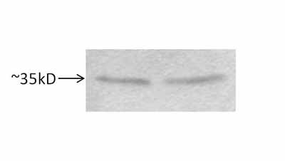Western blot - Anti-STUB1/CHIP antibody (AB2917), expandable thumbnail