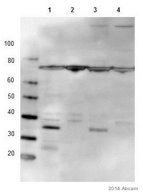 Western blot - Anti-STUB1/CHIP antibody [EPR4447] (ab134064), expandable thumbnail