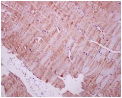 Immunohistochemistry (Formalin/PFA-fixed paraffin-embedded sections) - Anti-STUB1/CHIP antibody [EPR4447] - BSA and Azide free (AB238966), expandable thumbnail