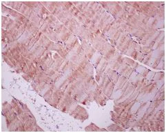 Immunohistochemistry (Formalin/PFA-fixed paraffin-embedded sections) - Anti-STUB1/CHIP antibody [EPR4447] - BSA and Azide free (AB238966)