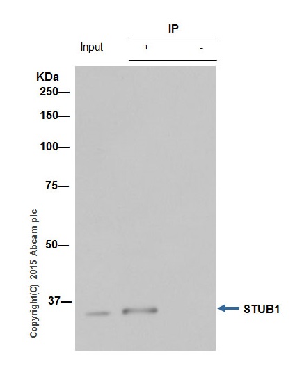 Immunoprecipitation - Anti-STUB1/CHIP antibody [EPR4447] - BSA and Azide free (AB238966), expandable thumbnail