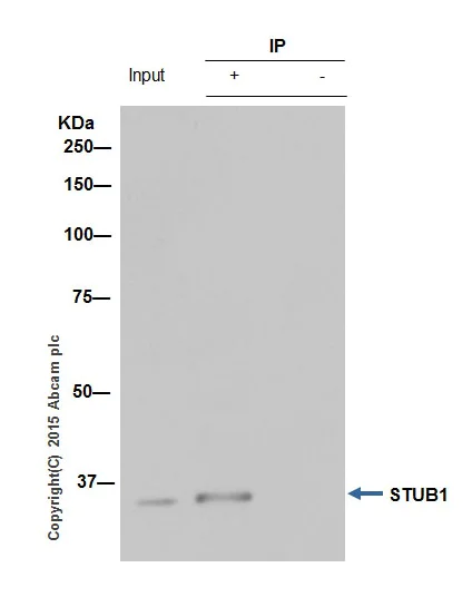 Immunoprecipitation - Anti-STUB1/CHIP antibody [EPR4447] - BSA and Azide free (AB238966)