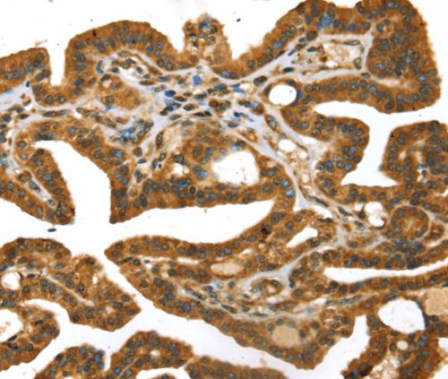 Immunohistochemistry (Formalin/PFA-fixed paraffin-embedded sections) - Anti-STX11 antibody (AB216046), expandable thumbnail