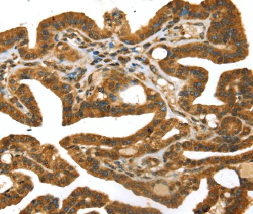 Immunohistochemistry (Formalin/PFA-fixed paraffin-embedded sections) - Anti-STX11 antibody (AB216046)
