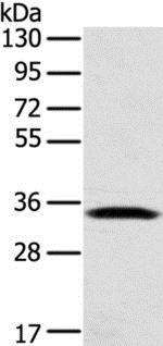 Western blot - Anti-STX11 antibody (AB216046), expandable thumbnail