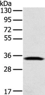 Western blot - Anti-STX11 antibody (AB216046)