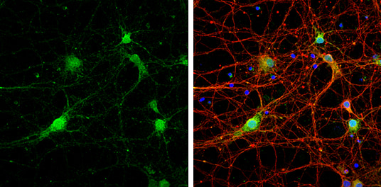Immunocytochemistry/ Immunofluorescence - Anti-STX17 antibody (AB229646), expandable thumbnail