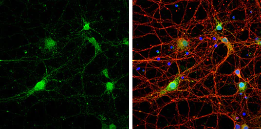 Immunocytochemistry/ Immunofluorescence - Anti-STX17 antibody (AB229646)