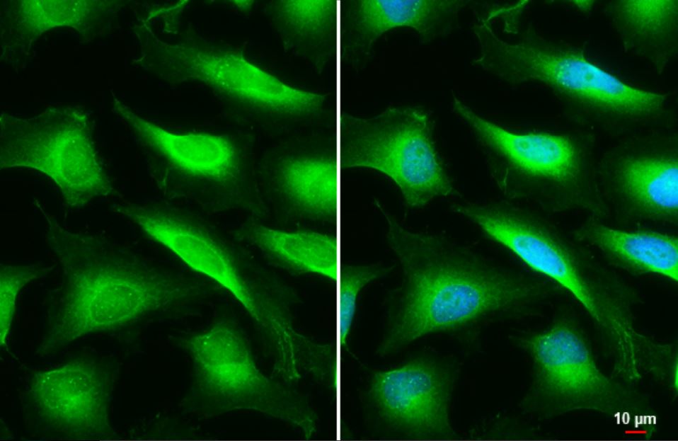 Immunocytochemistry/ Immunofluorescence - Anti-STX17 antibody (AB229646), expandable thumbnail