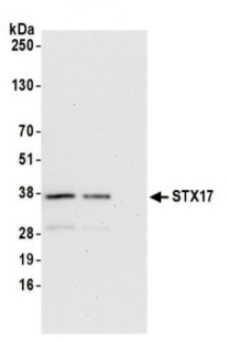 Immunoprecipitation - Anti-STX17 antibody (AB245637)