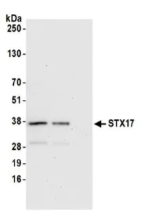 Immunoprecipitation - Anti-STX17 antibody (AB245637)