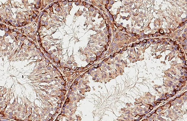Immunohistochemistry (Formalin/PFA-fixed paraffin-embedded sections) - Anti-STX17 antibody [HL3534] - BSA and Azide free (AB327518)