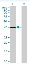 Western blot - Anti-STYXL1 antibody (AB67913), expandable thumbnail