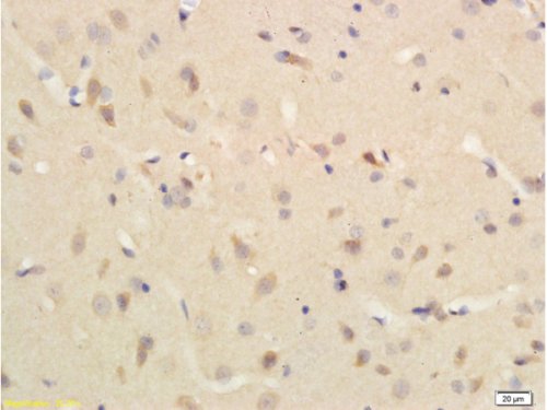 Immunohistochemistry (Formalin/PFA-fixed paraffin-embedded sections) - Anti-Substance P antibody (AB216414)