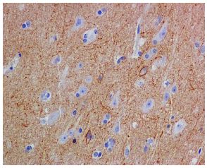 Immunohistochemistry (Formalin/PFA-fixed paraffin-embedded sections) - Anti-Substance P antibody [EPR3959] (AB133240), expandable thumbnail
