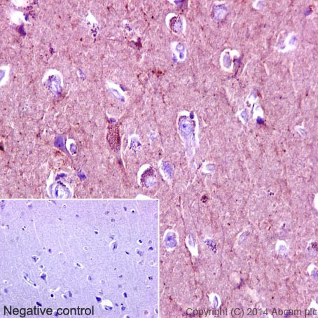 Immunohistochemistry (Formalin/PFA-fixed paraffin-embedded sections) - Anti-Substance P antibody [EPR3959] (AB133240), expandable thumbnail