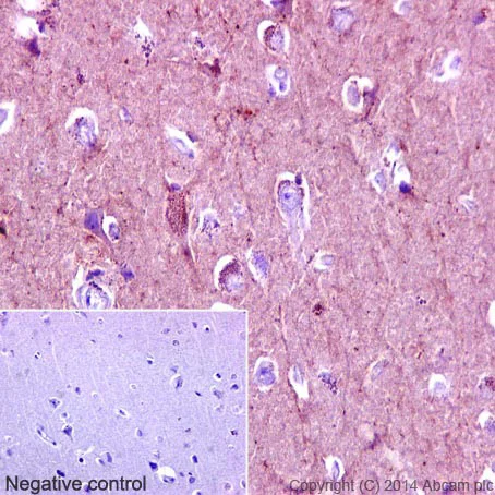 Immunohistochemistry (Formalin/PFA-fixed paraffin-embedded sections) - Anti-Substance P antibody [EPR3959] - BSA and Azide free (AB248419)