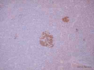 Immunohistochemistry (Formalin/PFA-fixed paraffin-embedded sections) - Anti-Substance P antibody [SP-DE4-21] (AB14184), expandable thumbnail