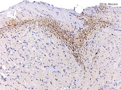 Immunohistochemistry (Formalin/PFA-fixed paraffin-embedded sections) - Anti-Substance P antibody [SP-DE4-21] (AB14184), expandable thumbnail
