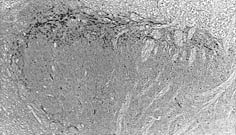 Immunohistochemistry (Formalin/PFA-fixed paraffin-embedded sections) - Anti-Substance P antibody [SP-DE4-21] (AB14184), expandable thumbnail