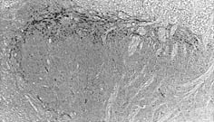 Immunohistochemistry (Formalin/PFA-fixed paraffin-embedded sections) - Anti-Substance P antibody [SP-DE4-21] (AB14184)