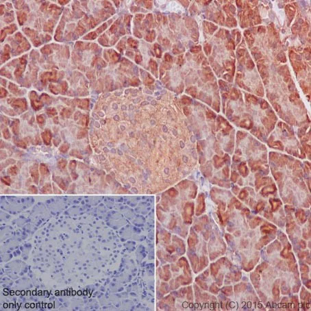 Immunohistochemistry (Formalin/PFA-fixed paraffin-embedded sections) - Anti-SUCLA2 antibody [EPR14924] - BSA and Azide free (AB251376)