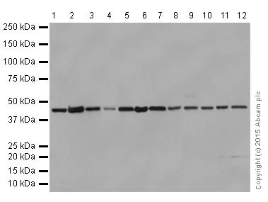 Western blot - Anti-SUCLA2 antibody [EPR14924] - BSA and Azide free (AB251376)