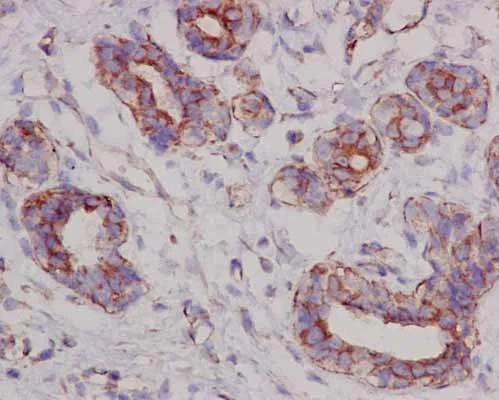 Immunohistochemistry (Formalin/PFA-fixed paraffin-embedded sections) - Anti-SUCLA2 antibody [EPR14925] - BSA and Azide free (AB250666)