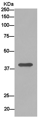 Immunoprecipitation - Anti-SUCLA2 antibody [EPR14925] - BSA and Azide free (AB250666), expandable thumbnail