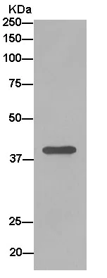 Immunoprecipitation - Anti-SUCLA2 antibody [EPR14925] - BSA and Azide free (AB250666)