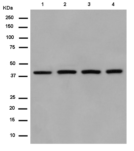 Western blot - Anti-SUCLA2 antibody [EPR14925] - BSA and Azide free (AB250666), expandable thumbnail