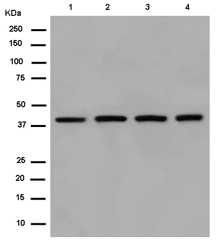 Western blot - Anti-SUCLA2 antibody [EPR14925] - BSA and Azide free (AB250666)