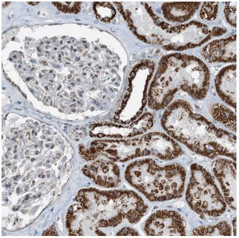 Immunohistochemistry (Formalin/PFA-fixed paraffin-embedded sections) - Anti-SUCLG1 antibody (AB204432)