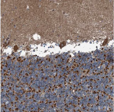 Immunohistochemistry (Formalin/PFA-fixed paraffin-embedded sections) - Anti-SUCLG1 antibody (AB204432)