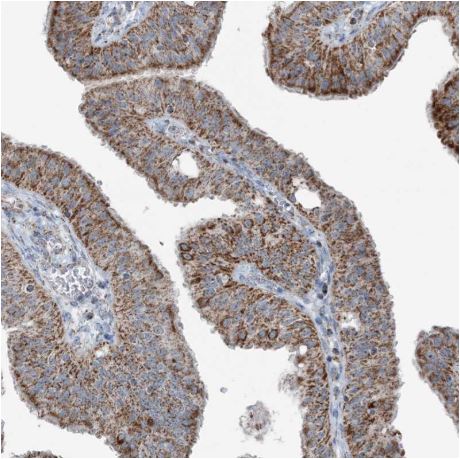 Immunohistochemistry (Formalin/PFA-fixed paraffin-embedded sections) - Anti-SUCLG1 antibody (AB204432), expandable thumbnail
