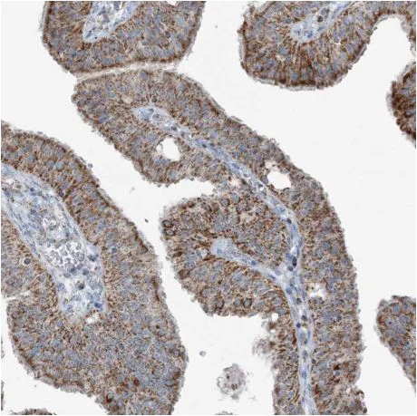 Immunohistochemistry (Formalin/PFA-fixed paraffin-embedded sections) - Anti-SUCLG1 antibody (AB204432)