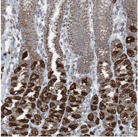 Immunohistochemistry (Formalin/PFA-fixed paraffin-embedded sections) - Anti-SUCLG1 antibody (AB204432)