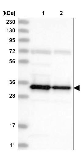 Western blot - Anti-SUCLG1 antibody (AB204432), expandable thumbnail