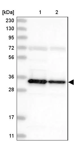 Western blot - Anti-SUCLG1 antibody (AB204432)