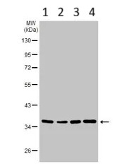 Western blot - Anti-SUCLG1 antibody (AB97867)