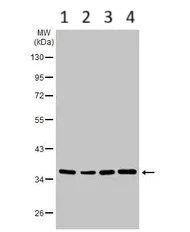 Western blot - Anti-SUCLG1 antibody (AB97867)